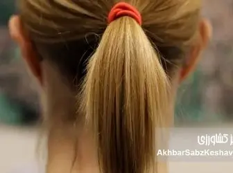 هشدار! این ۳ ماده خوراکی، قاتل خاموش موهای شما هستند!